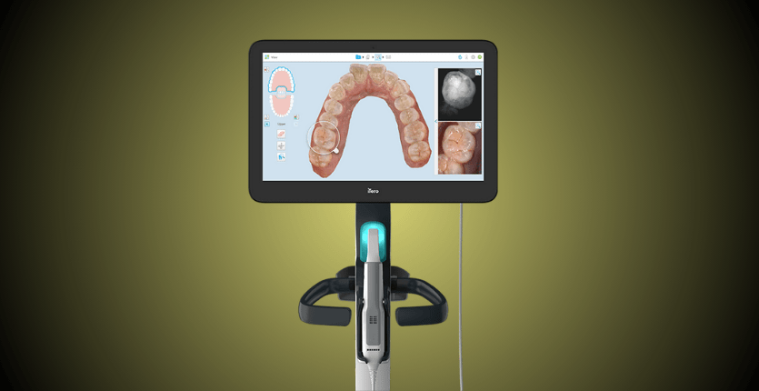 Scanner_intraoral_iTero Element™ Plus