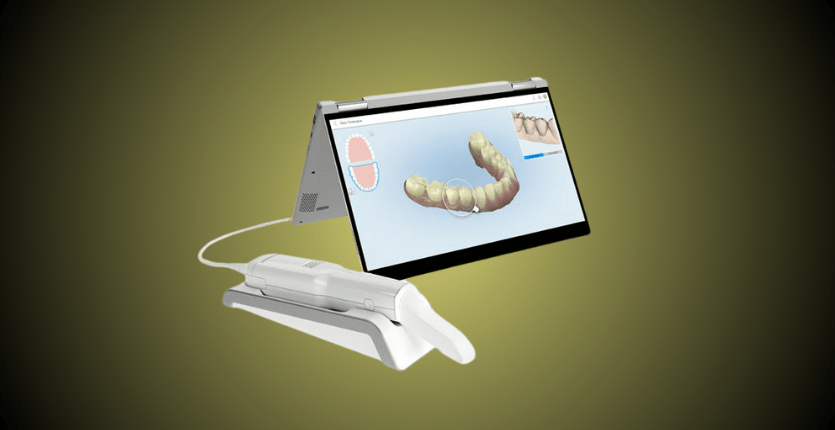 Scanner Intra-oral iTero Element™ 2
