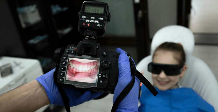 Photographie dentaire